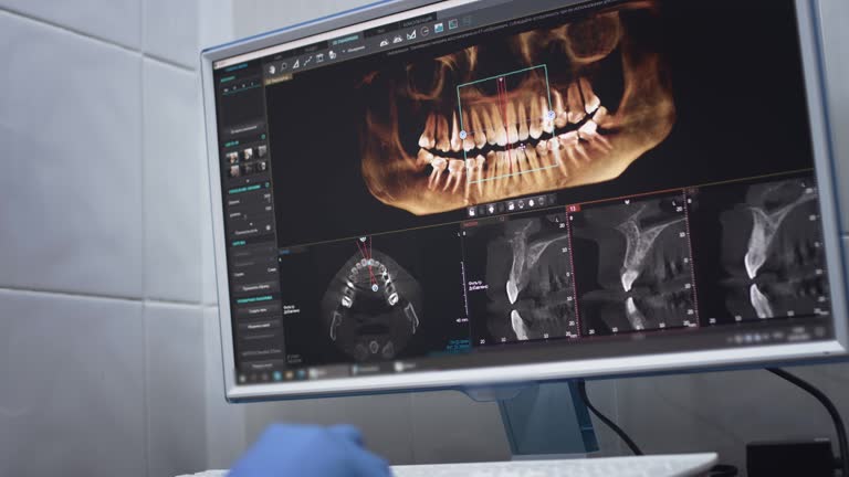 Oral Cancer Screening in San Luis Obispo, CA